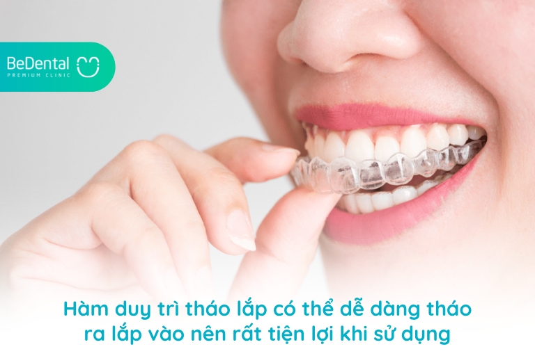 Cách tháo lắp hàm duy trì đảm bảo vệ sinh an toàn 4 Hàm duy trì tháo lắp rất được ưa chuộng rộng rãi