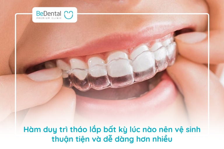 Cách tháo lắp hàm duy trì đảm bảo vệ sinh an toàn 8 Cách tháo lắp hàm duy trì đúng cách và vệ sinh cẩn thận