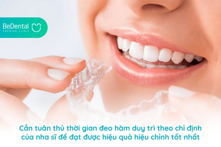Cách tháo lắp hàm duy trì đảm bảo vệ sinh an toàn 9 Cần bảo đảm thời gian đeo hàm duy trì để đạt được hiệu quả tốt nhất