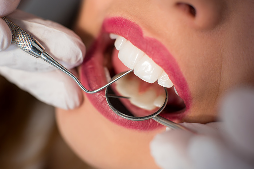 Lý do khám răng : Cải Thiện Thẩm Mỹ Của Răng