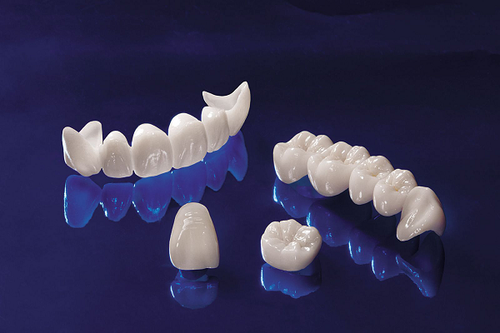 bọc răng sứ hay trồng răng implant sẽ tốt hơn