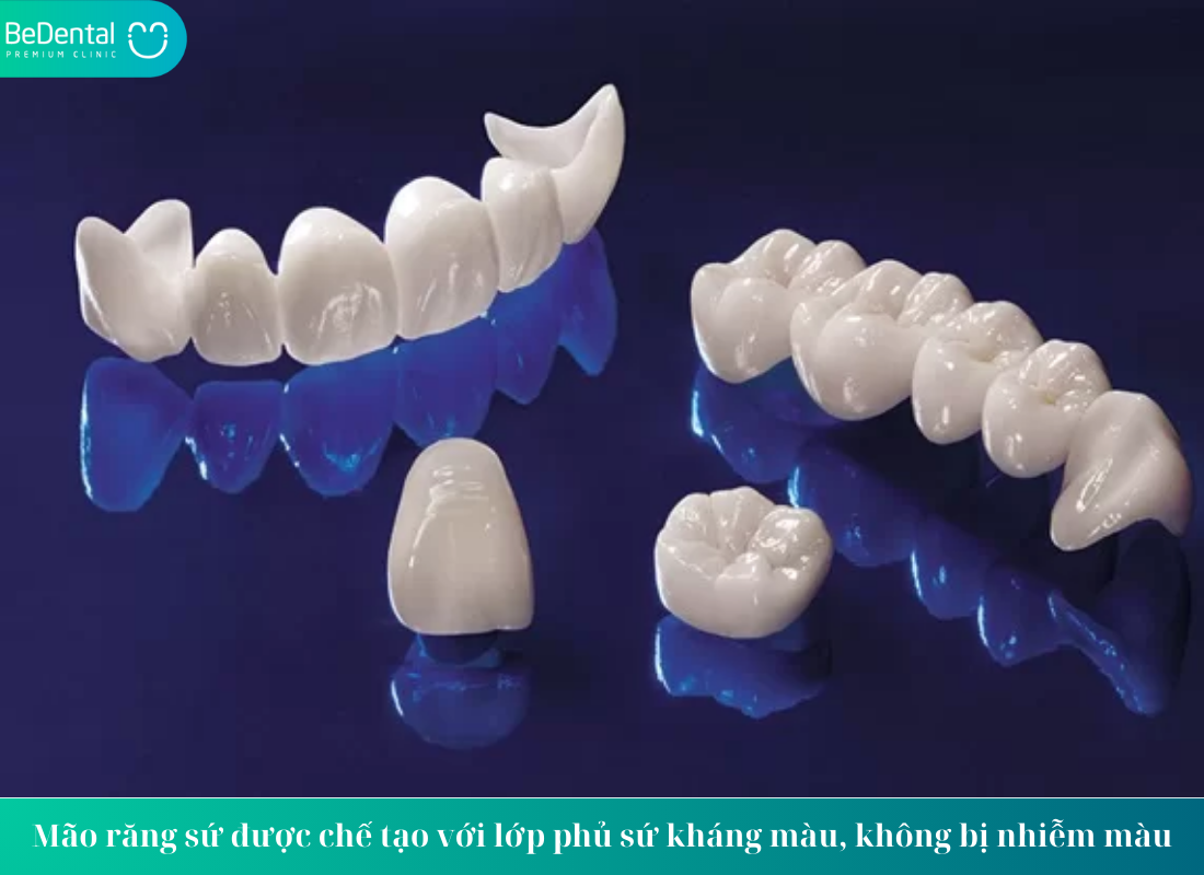 Mão răng sứ là gì?