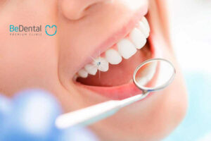 Bọc răng sứ có được vĩnh viễn không? Tuổi thọ trung bình của răng sứ ra sao?