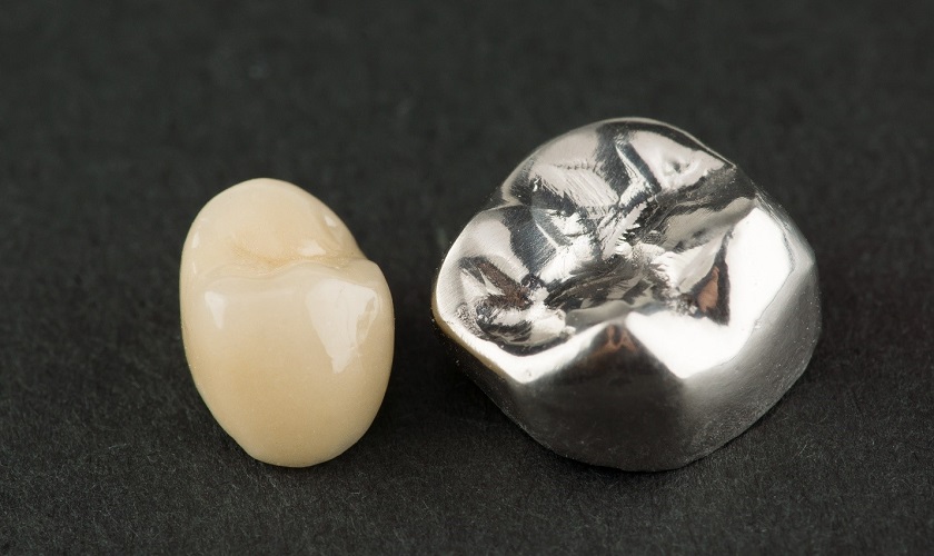 Răng titan bị đen có nguy hiểm không?