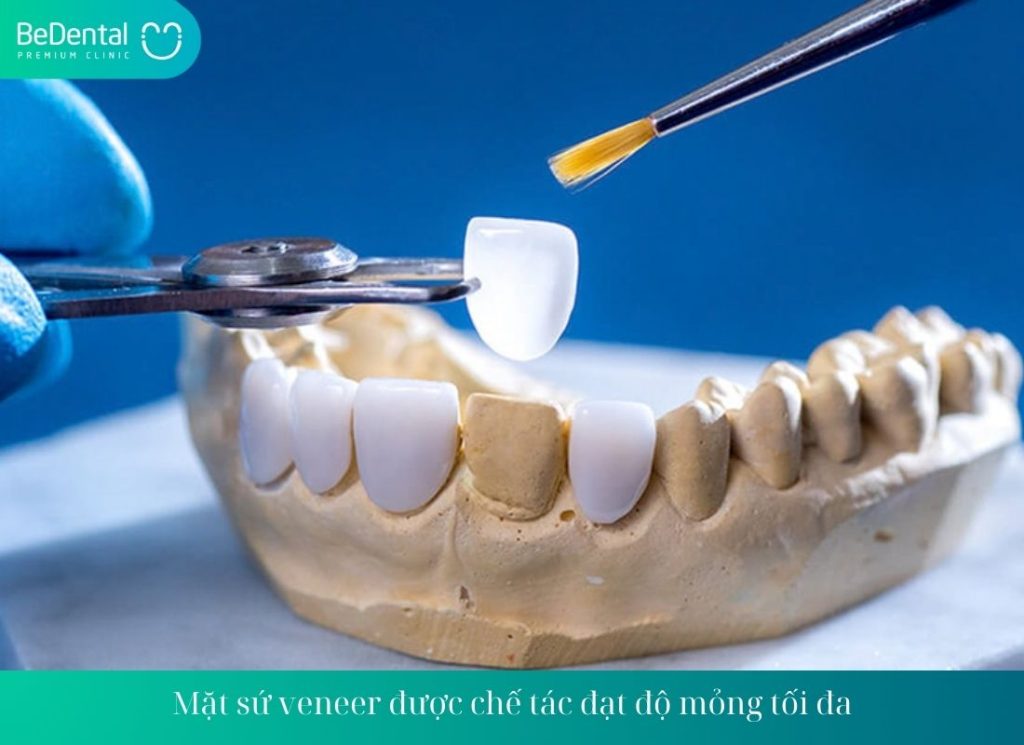 Mặt sứ veneer được chế tác đạt độ mỏng tối đa