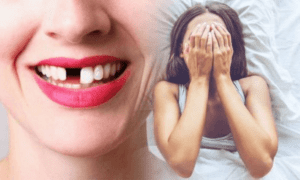 Rụng răng ở tuổi trưởng thành khiến chúng ta mất tự tin
