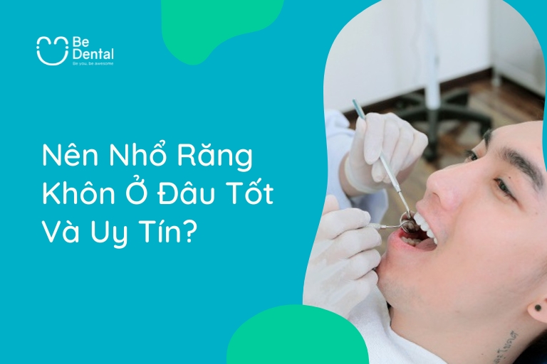 Nên nhổ răng khôn ở đâu tốt và uy tín?