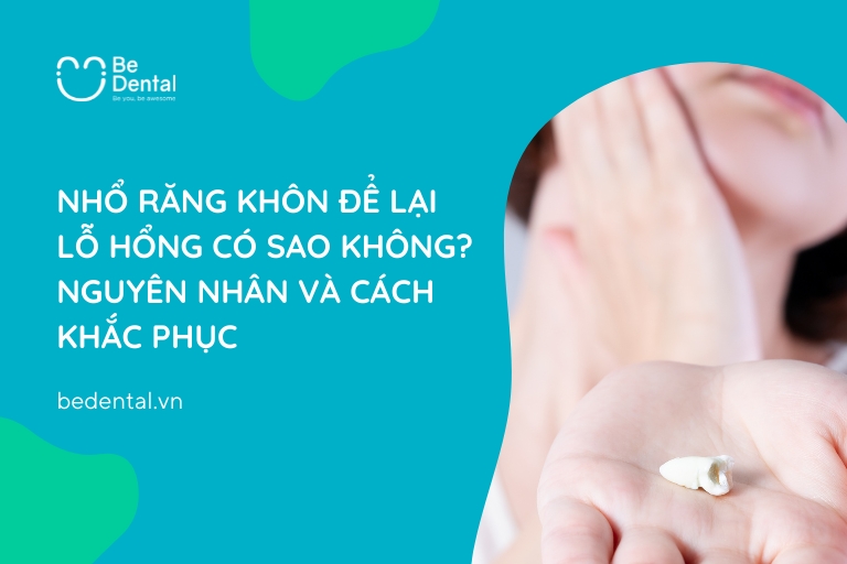 Nhổ Răng Khôn Để Lại Lỗ Hổng Có Sao Không, Nguyên Nhân Và Cách Khắc Phục