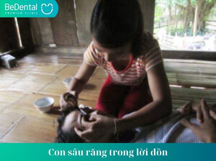 Bắt con sâu răng bằng lá tía tô