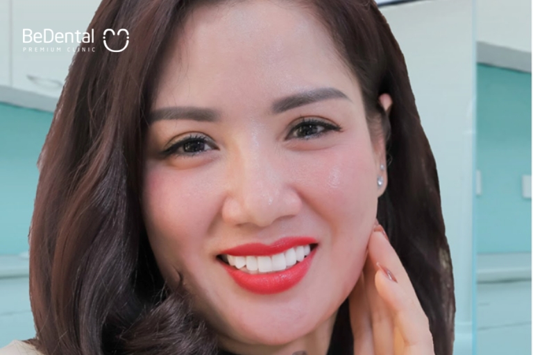 Lấy Cao Răng Ở Đâu Tốt? Địa chỉ lấy cao răng uy tín ở sài gòn 3 Bọc răng sứ thay đổi phong thủy