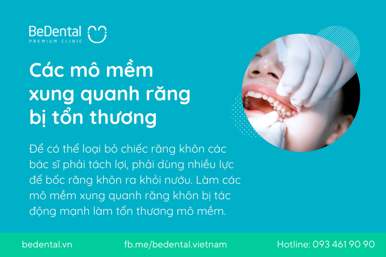 Nguyên nhân tại sao nhổ răng khôn bị đau họng