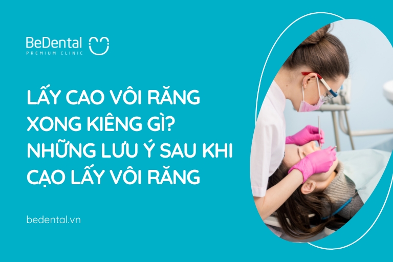 Lấy Cao Răng Xong Kiêng Gì? Những Lưu Ý Sau Khi Cạo Lấy Vôi Răng