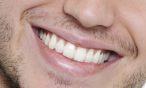 hàm răng đẹp nam tính có kích thước vừa phải cân đối