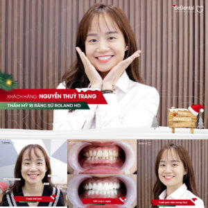 Khách hàng Nguyễn Thùy Trang làm Răng sứ Roland HD tại nha khoa Bedental