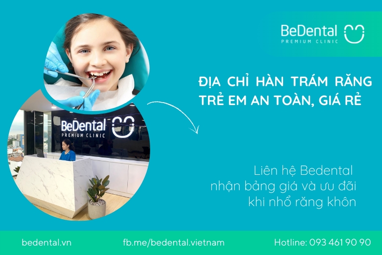 BeDental là địa chỉ hàn răng trẻ em an toàn, giá rẻ