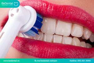 vệ sinh răng miệng sau khi bọc sứ toàn hàm