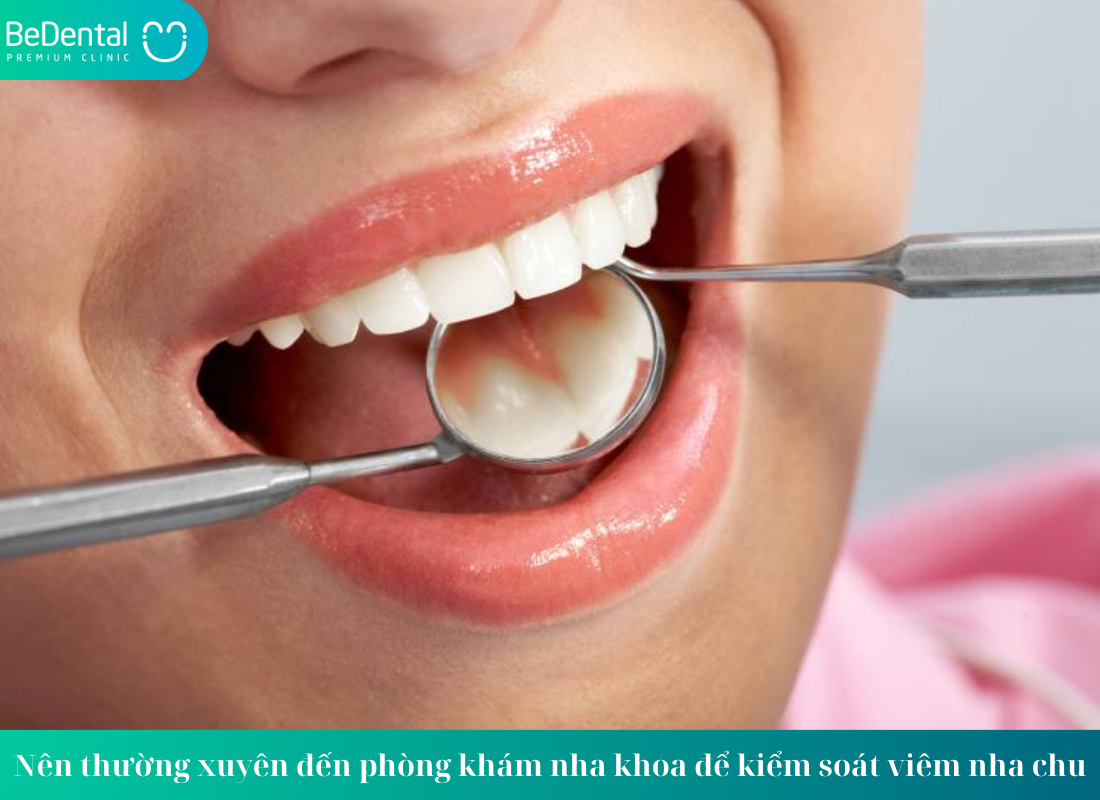 Dấu hiệu viêm nha chu: Cách nhận biết sớm và điều trị hiệu quả 6 Cách chăm sóc và phòng ngừa viêm nha chu