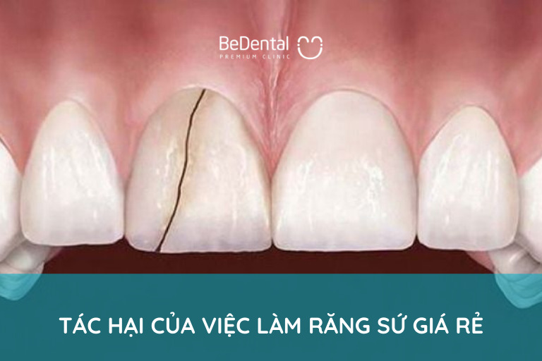 Tác hại nghiêm trọng của làm răng sứ giá rẻ gây ra hôi miệng và các bệnh lý răng miệng