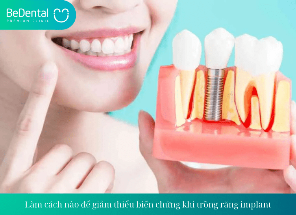 Làm cách nào để giảm thiểu biến chứng khi trồng răng implant