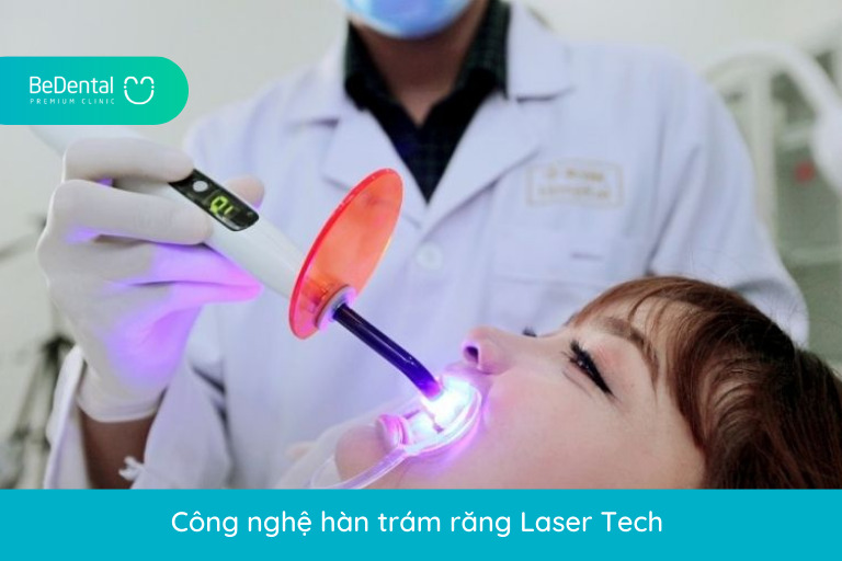 Công nghệ hàn trám răng Laser Tech