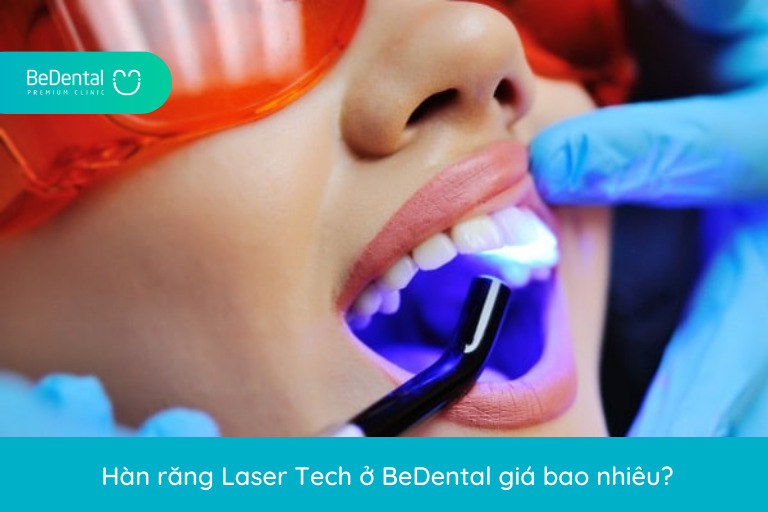 Hàn răng Laser Teach giá bao nhiêu