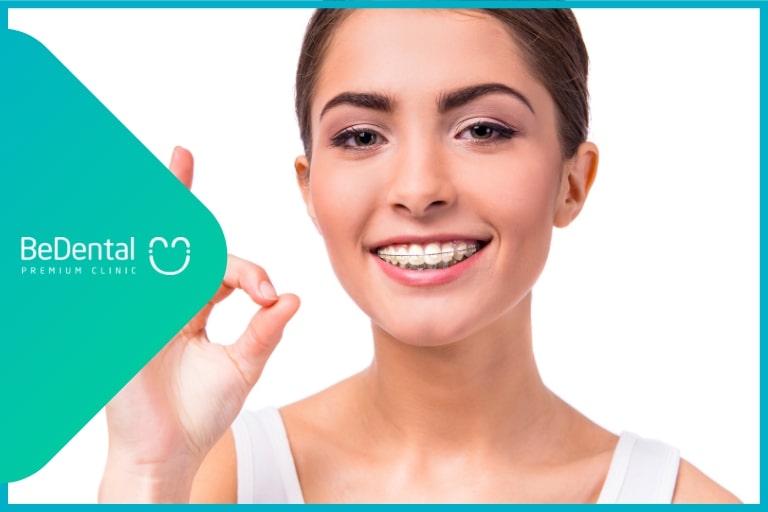 Siết răng khi niềng răng là gì?Mẹo làm giảm đau khi niềng siết răng