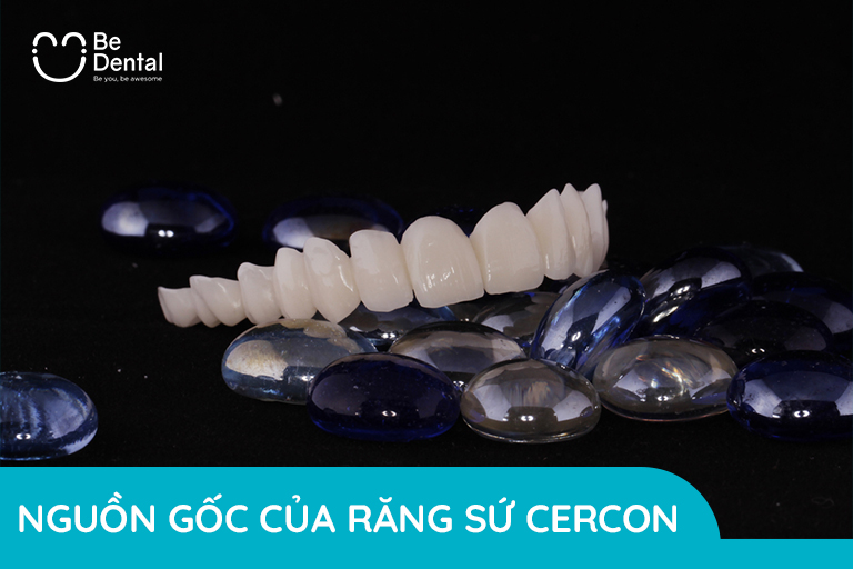 Nguồn gốc của răng sứ cercon
