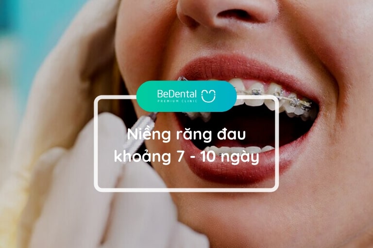 Niềng răng thường đau khoảng 7 - 10 ngày