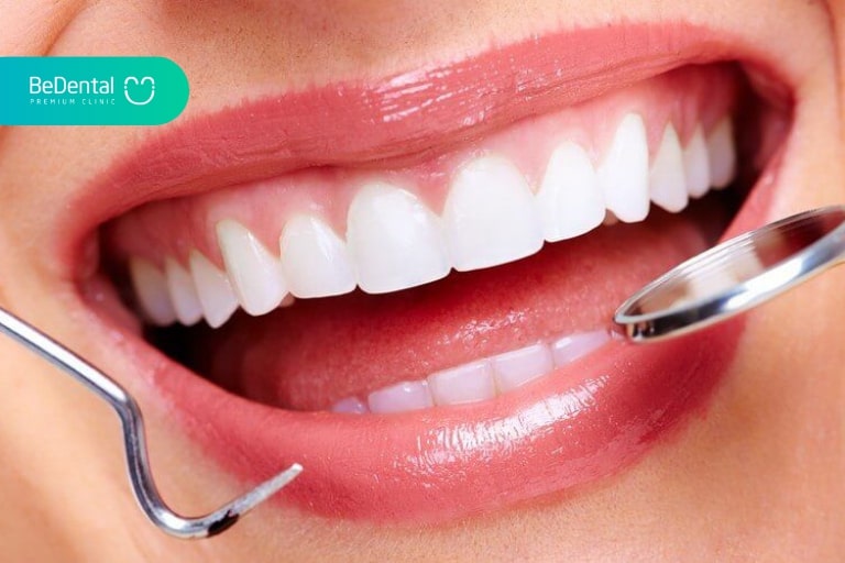 Niềng răng có phải nhổ răng không phụ thuộc vào tình trạng sức khỏe răng hiện tại