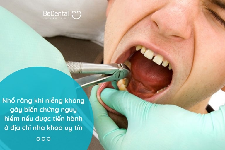 Nhổ răng khi niềng không ảnh hưởng quá nhiều đến sức khỏe của bạn