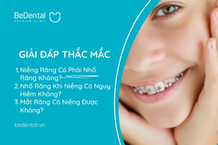 Niềng Răng Có Phải Nhổ Răng Không? Nhổ Răng Khi Niềng Có Nguy Hiểm Không? Mất Răng Có Niềng Được Không?