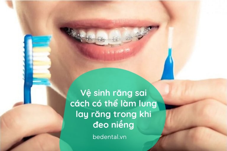 Vệ sinh răng miệng không đúng sẽ làm lung lay răng