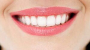 Răng đều hạt bắp trông như thế nào?