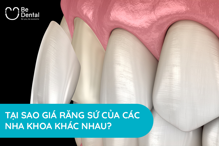 Tại sao giá bọc răng sứ của các nha khoa lại khác nhau