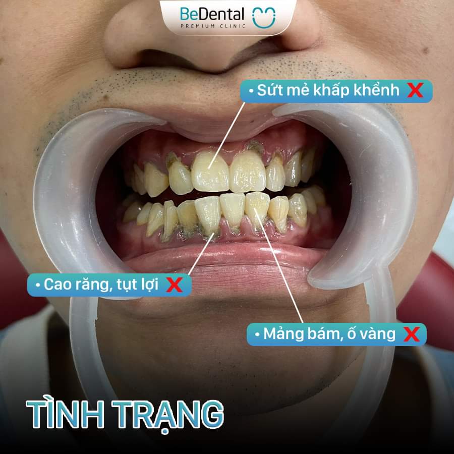 Tình trạng răng của khách hàng
