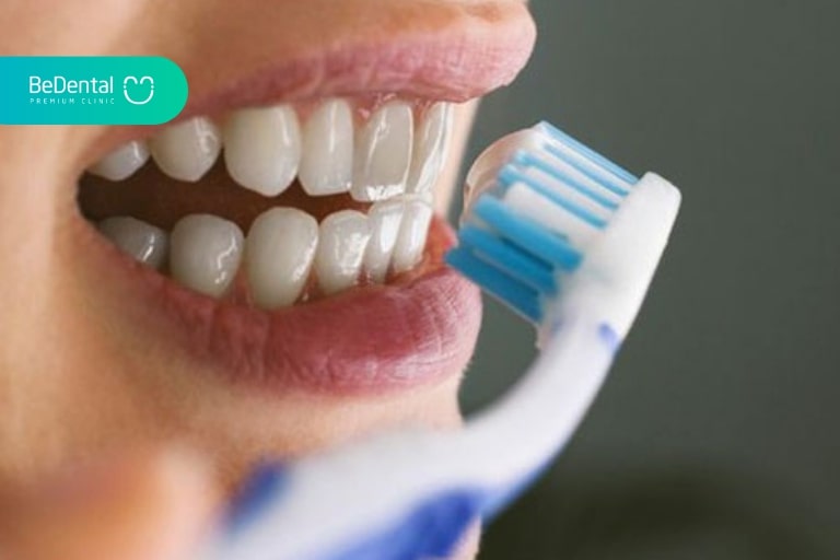 Trám răng xong có nên đánh răng không?