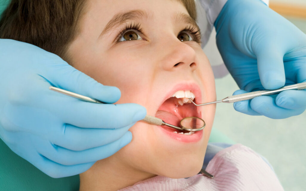 sâu răng; sâu răng ở trẻ; dự phòng sâu răng; dự phòng sâu răng ở trẻ;