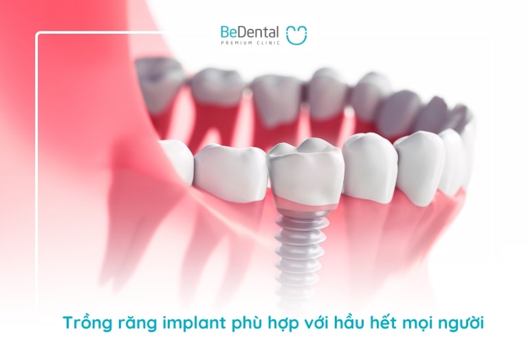 Cấy ghép răng implant phù hợp với những ai?