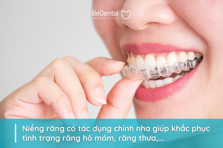 Niềng răng là phương pháp chỉnh nha giúp khắc phục tình trạng răng hô móm, răng thưa, răng mọc chen lấn,...