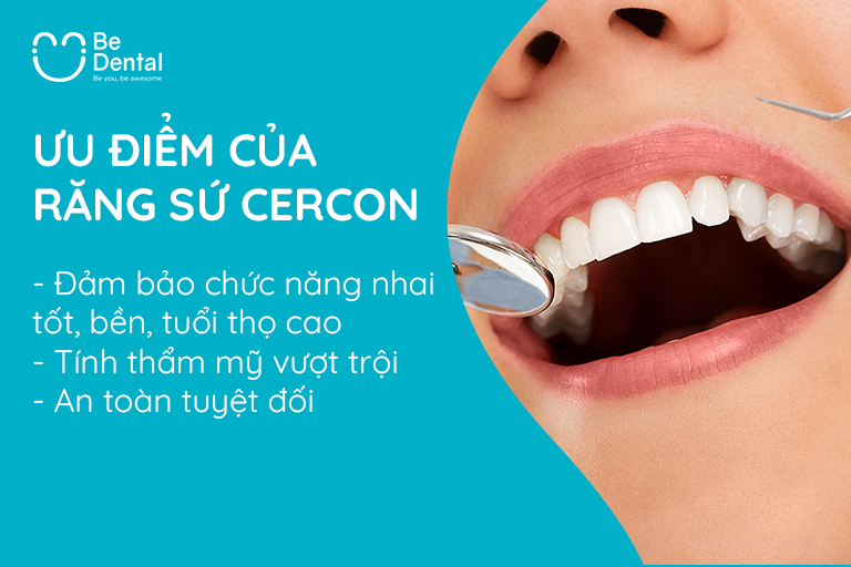 Ưu điểm của răng sứ cercon