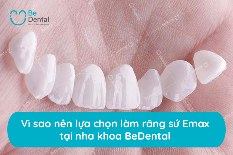 Vì sao nên chọn làm răng sứ emax tại nha khoa Bedental