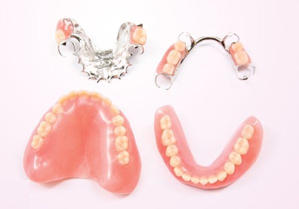 răng giả hàm tháo lắp; răng giả; quy trình làm răng giả hàm tháo lắp; nha khoa bedental;