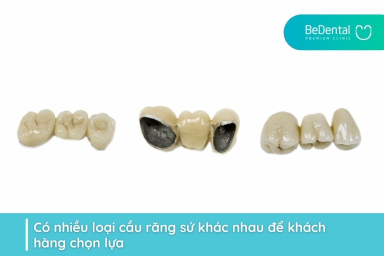 Có nhiều loại cầu răng sứ khác nhau