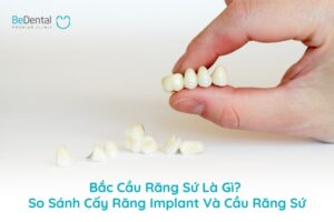 Bắc Cầu Răng Sứ Là Gì? So Sánh Cấy Răng Implant Và Cầu Răng Sứ