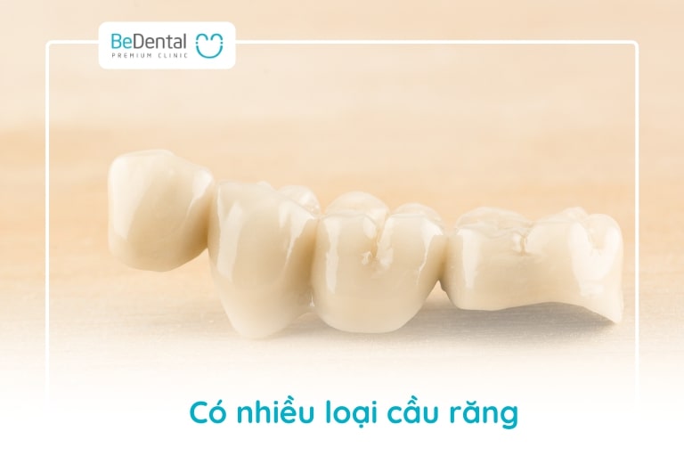 Có nhiều loại cầu răng để bạn chọn như: cầu răng truyền thống, cầu răng nhảy, cầu răng với/đèo, cầu răng cánh dán, cầu răng composite