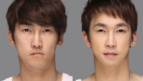 Tác hại từ thói quen nhai một hàm