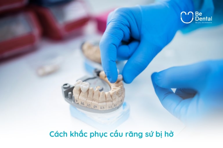 Tùy từng mức độ hở của cầu răng mà bác sĩ sẽ đưa ra phương án khắc phục phù hợp