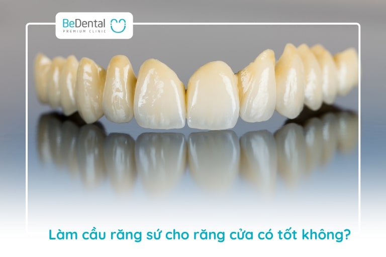 Làm cầu răng sứ răng cửa mang tới tính thẩm mỹ toàn diện, phục hồi chức năng nhai nhanh chóng với tuổi thọ cầu răng cao, giá thành rẻ