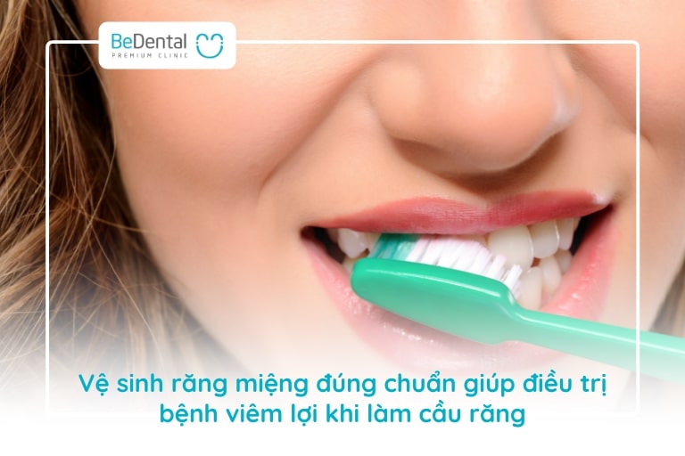Cần biết cách chải răng để ngăn ngừa viêm lợi