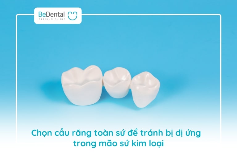 Chọn răng toàn sứ sẽ ngăn ngừa được nguy cơ dị ứng kim loại và bệnh lý viêm lợi